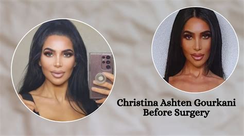 christina ashten before surgery|christina ashten net worth before surgery.